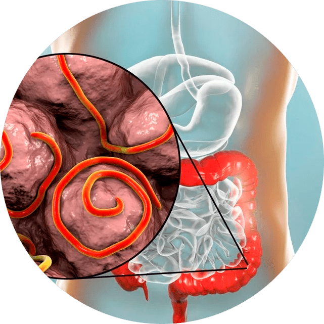 Γαστρεντερική οδός και παράσιτα