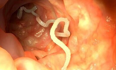 αιτίες παρασίτων στο ανθρώπινο σώμα