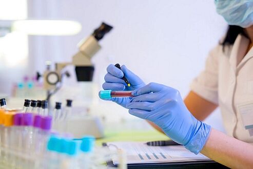εξέταση αίματος για παράσιτα